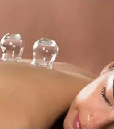 Dry Needling and Cupping