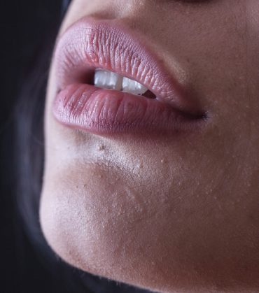 Facial Volume & Contouring