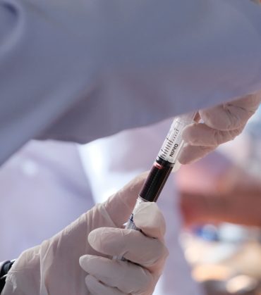 PRP Therapy